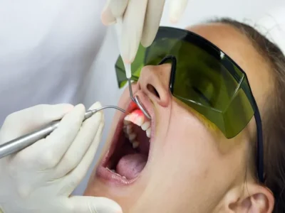 laser used in dentistry