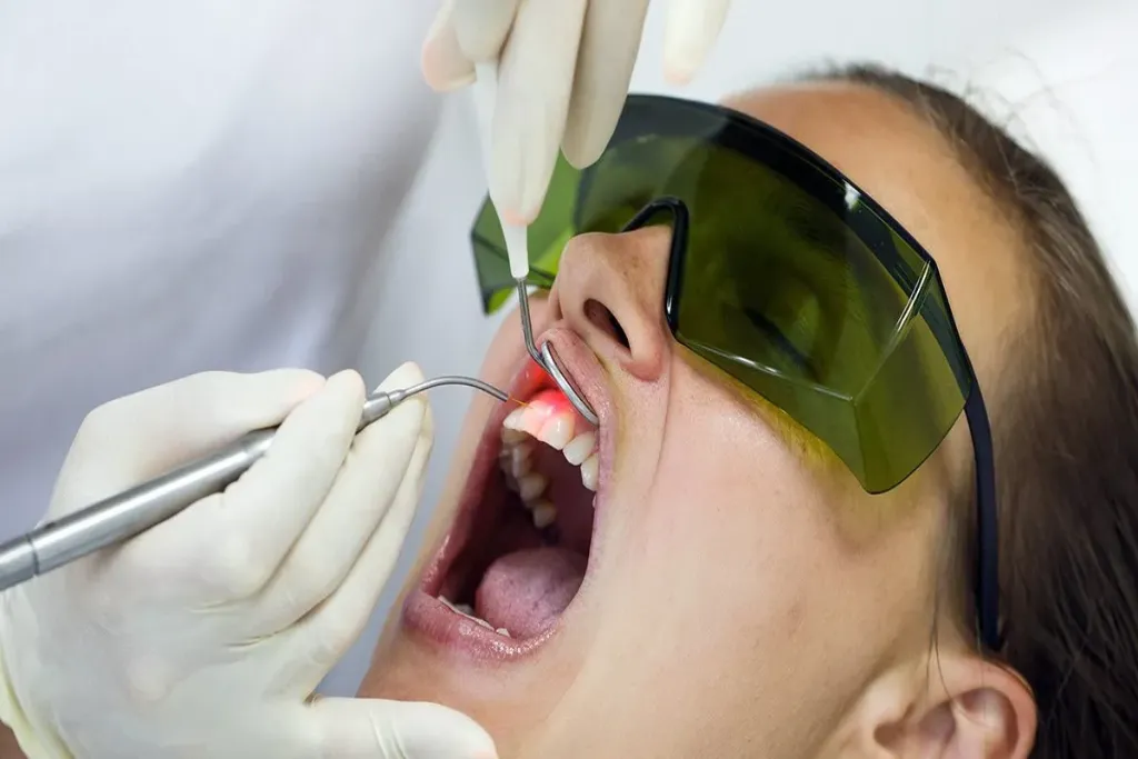 laser used in dentistry