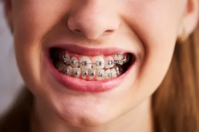 Read more about the article The Impact of Orthodontic Treatments on Your Overall Health