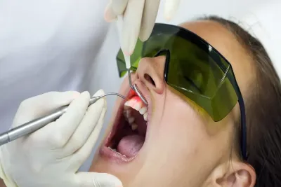 How Does Laser Dentistry Compare to Traditional Techniques