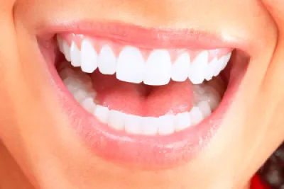 Top 10 Ways to Keep Your Teeth White and Healthy
