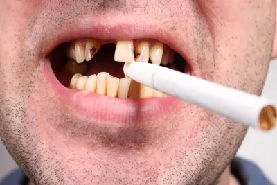 The Smoking Truth: How Tobacco Impacts Dental Health