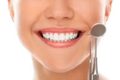Unmasking Myths: The Truth About Dental Veneers
