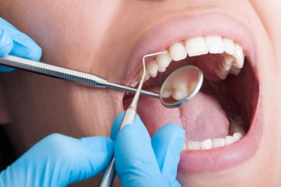 Dealing with Sensitive Teeth Causes and Solutions